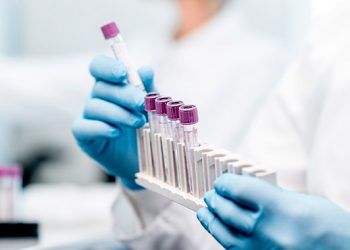 Gestão da qualidade em laboratórios de análises clínicas: 9 erros mais comuns