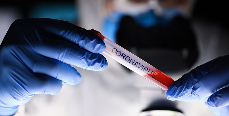 Como serão os laboratórios de análises clínicas após a pandemia do novo coronavírus?