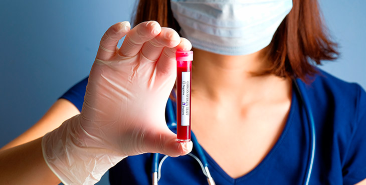 Coronavírus, crise e gerenciamento de riscos em laboratórios de análises clínicas